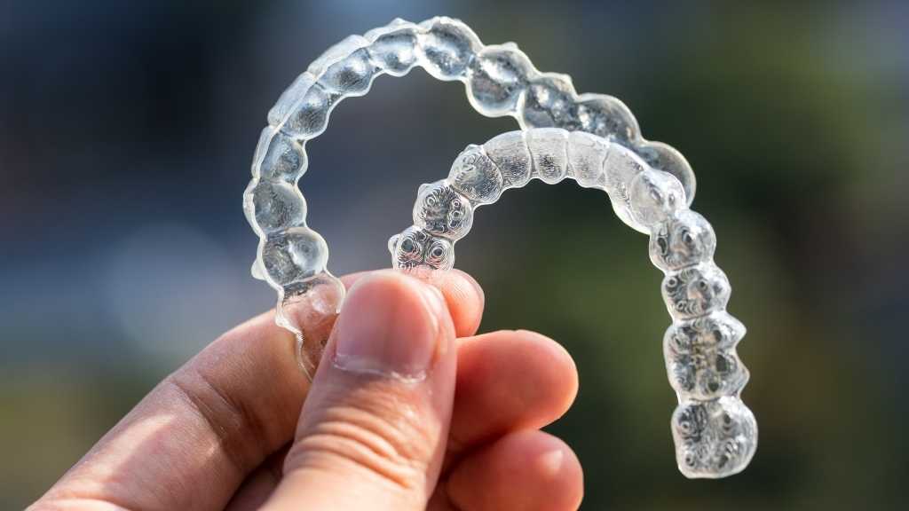 Invisalign treatment toronto danforth