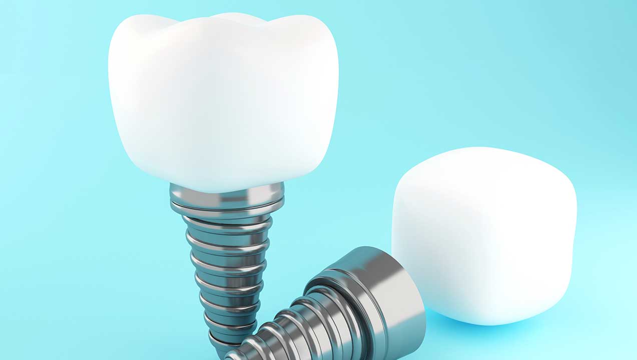 Cost of Dental Implants Near Me Toronto Implant Clinic