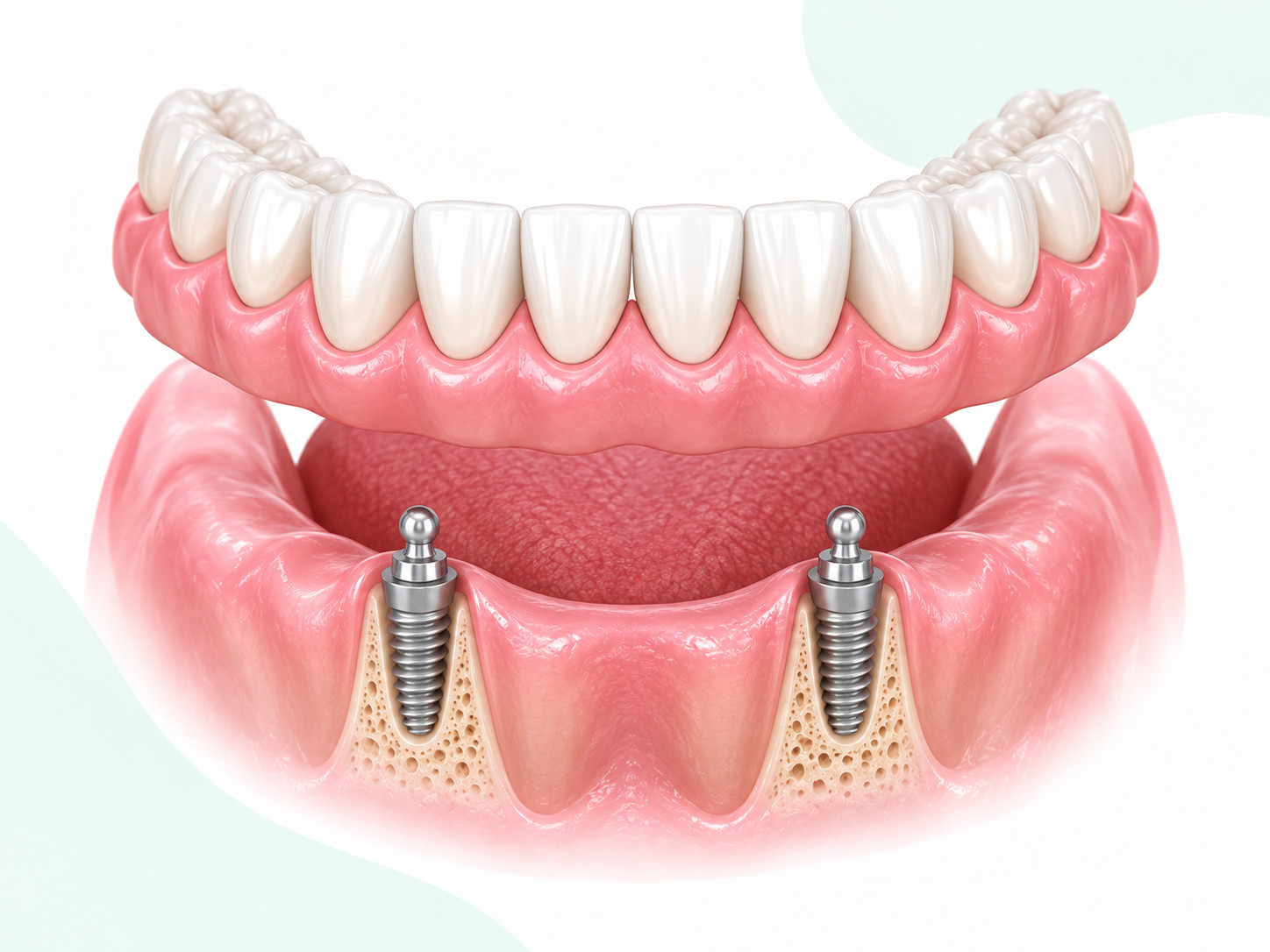 Placeholder — mild, moderate, or complex case